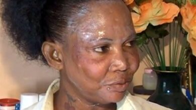 Photo of A 24-year-old Law Attracting 5,000 Dalasis Fine -Gambia, A Country Whose Government Wants to Legalize Skin-Bleaching